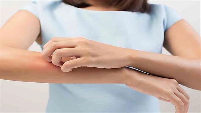 أبرز أسباب حدوث "الحكة" وطرق علاجها