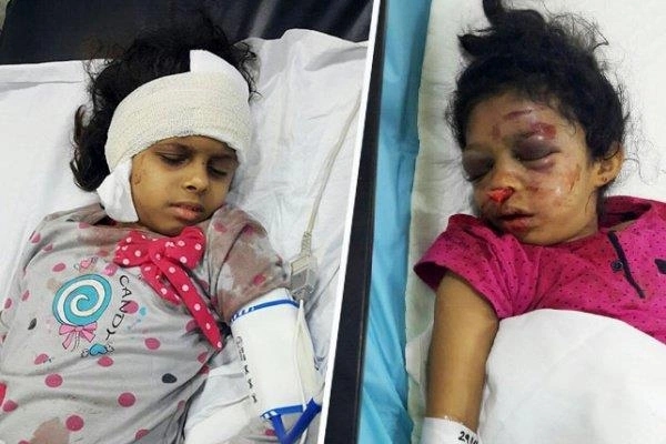 والد الطفلتين المصابتين جراء اعتداء الخادمة : ادعت نزول الوحي وابلغها بوفاة امها