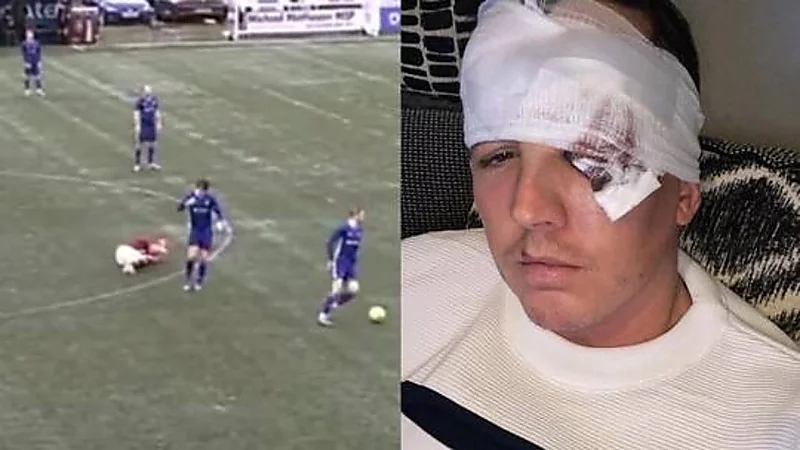 شاهد.. لاعب ينطح منافسه بوحشية خلال مباراة كرة قدم