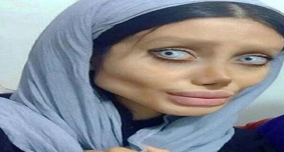 بالصور.. أرادت أن تشبه " أنجلينا جولي ".. فتاة إيرانية أصبحت شبحا مخيفا 