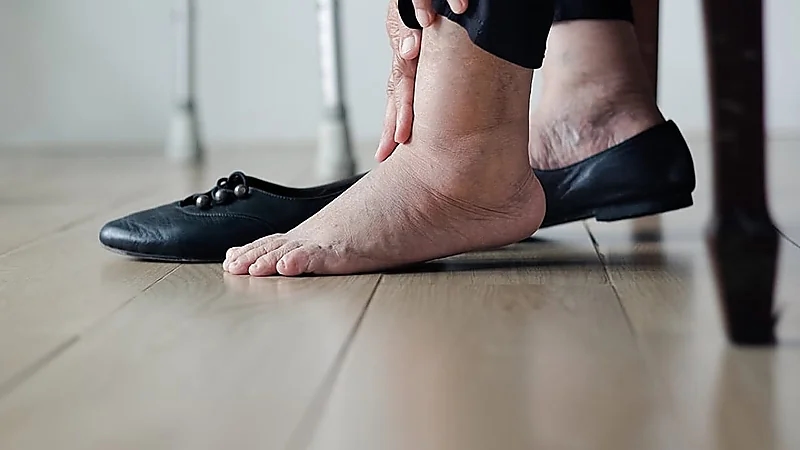 احذر .. 5 علامات تظهر على الساقين تشير إلى مشاكل صحية خطيرة
