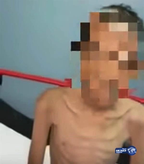 بالفيديو.. عم "معنفي خيبر": الطفل يعاني من هذيان  وحالة بدنية سيئة ..والام لاتزال طليقة