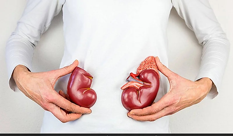 الموافقة على استخدام " فيرينون " لعلاج المصابون بمرض الكلى المزمن