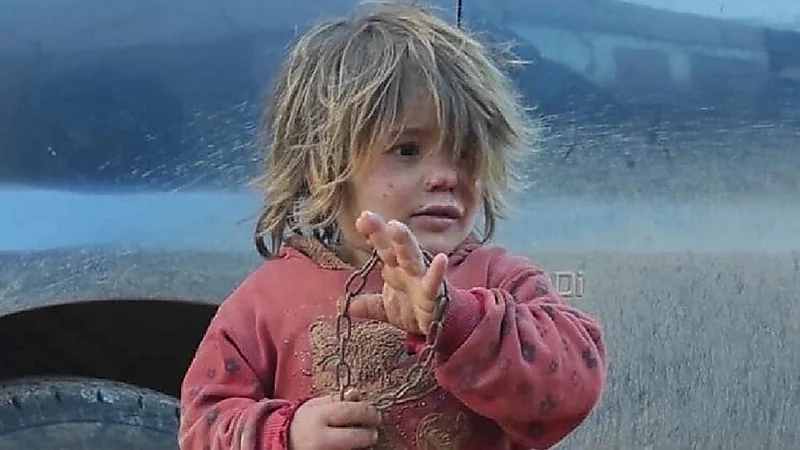 والد الطفلة التي هزت صورتها العالم يكشف حقيقة تعنيفها وموتها جوعا