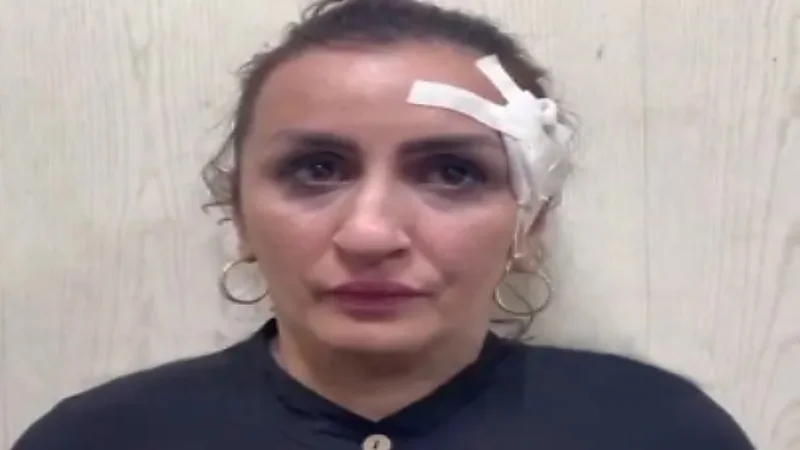 ضبط أم باعت رضيعها لإجراء عملية تجميل في أنفها
