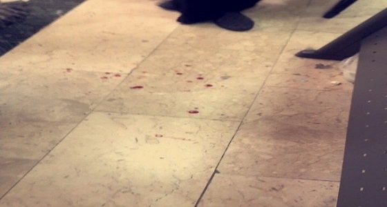 وقوع مضاربة جماعية بين طالبات باستخدام المشارط في جامعة الطائف