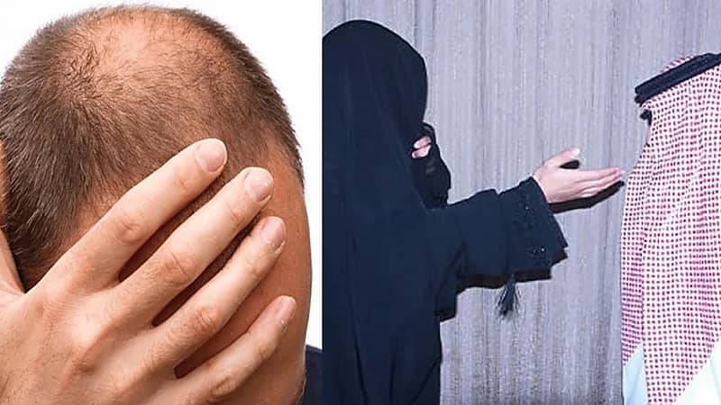 مواطنة تطلب الطلاق بعد أول يوم زواج: "اكتشفت إنه أصلع"