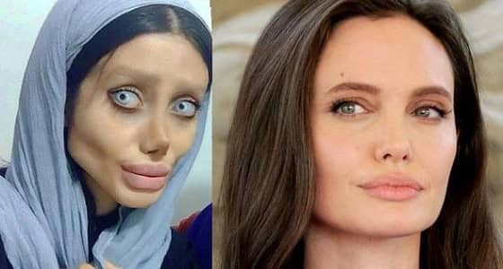 بالفيديو.. هوس فتاة بعمليات التجميل يحولها لهيكل عظمي