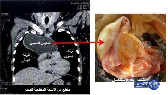 توطين قطاع الاتصالات ينقل شباب سعوديين بمحافظة خيبر من موظفين إلى رواد ومستثمرين