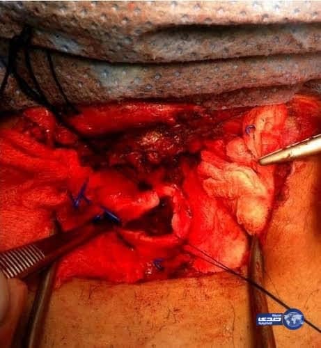 بالفيديو .. لحظة مداهمة غرف مكدسة بالعمالة في الرياض