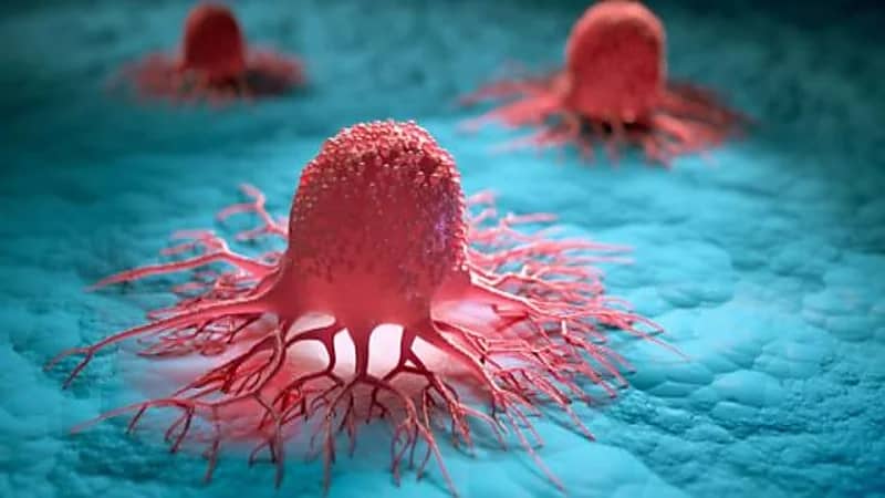 آلية جديدة توضح طريقة وسبب انتشار الخلايا السرطانية