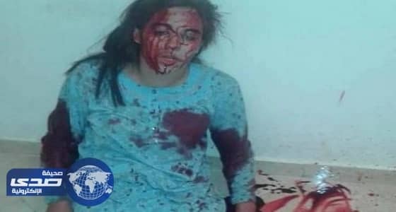 شاب يعتدي على ابنة عمه بالسكين لرفضها الزواج منه