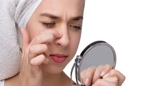 وصفة منزلية للتخلص من الرؤوس السوداء