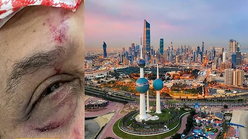كويتيون يتهمون موظفي مركز صحي بضرب والدهم المسن