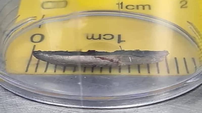 إنقاذ عين مقيم بعد اختراق أداة حديدية لها