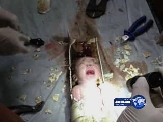 المرور: ضبط 429 مركبة مخالفة استهدفوا مواقف أماكن ذوي الاحتياجات الخاصة