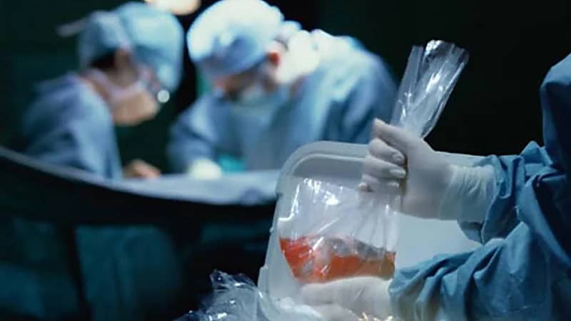 جراح مزيف يفتح بطن سيدة ويسرق كليتيها ويهرب