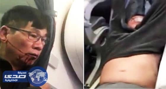 " يونايتد إيرلاينز " تبرم اتفاق مع الراكب المطرود بالقوة من احدى رحلاتها