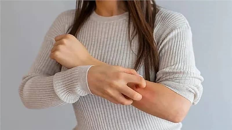 استشاري جلدية يوضح فئة من الأشخاص يتأثرون سلبًا بارتداء الصوف