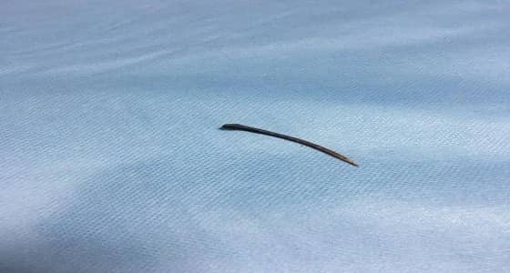 شوكة تخترق أمعاء مريض بعد تناوله وجبة سمك