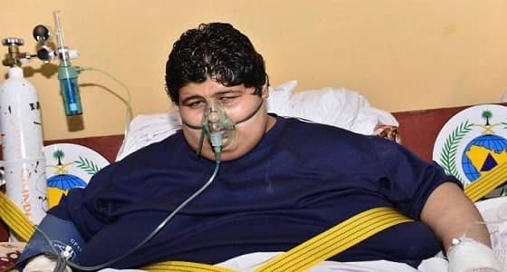 شاهد.. تغير خطير في حالة خالد شاعري مريض السمنة بعد 4 سنوات