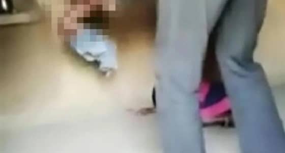 بالصور.. أب يعتدي على أطفاله بوحشية