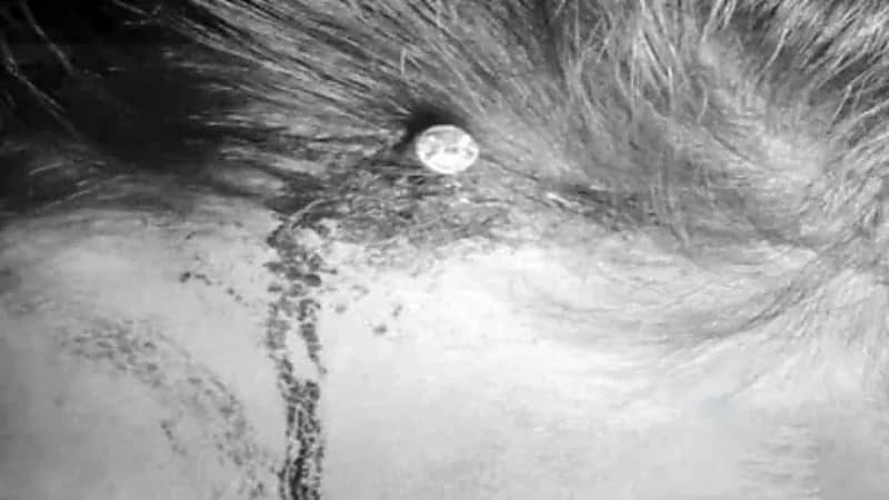 واقعة غريبة لـ "ساحر" دق مسمارًا في رأس امرأة لتحمل (صور)