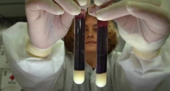 مرض خطير ينتشر مُستقبلاً بين البشر ويسبب الوفاة .. تعرف عليه