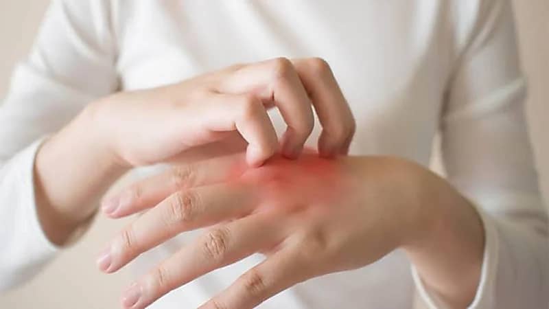 طريقة الوقاية من تورم الأصابع خلال فصل الشتاء