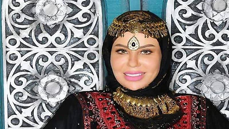 شمس الأسطورة بشفاه منتفخة في أحدث ظهور لها