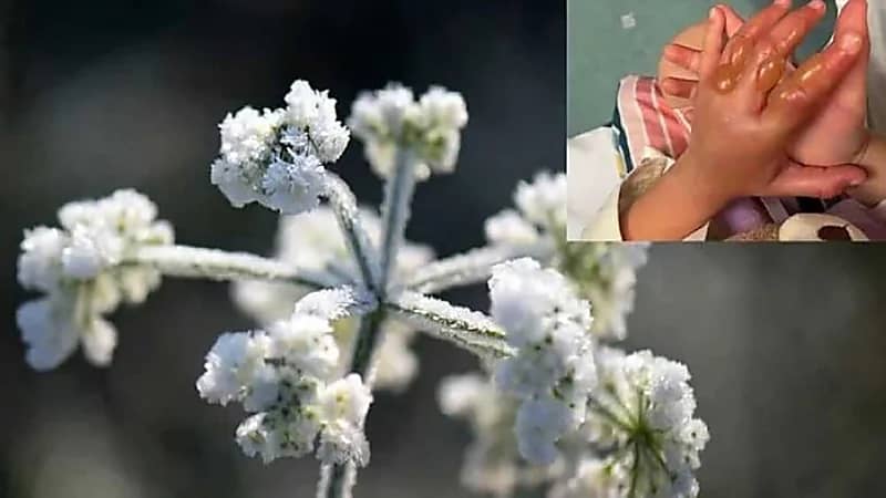 نبتة خطيرة تصيب طفلة بحروق في يدها 