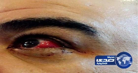 الاعتداء على وكيل مدرسة بالدمام و"التعليم" تحقق بالواقعة