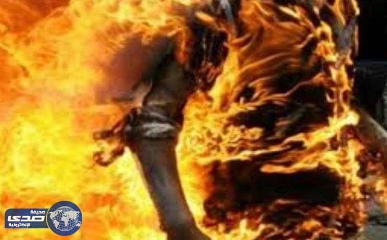 إصابات خطيرة لمواطن حاول حرق نفسه بتربة