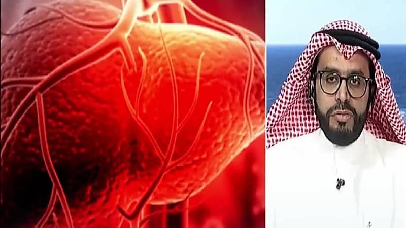 استشاري:  التهاب الكبد يصيب الأطفال الذين متوسط أعمارهم من سنتين إلى 5 سنوات (فيديو)