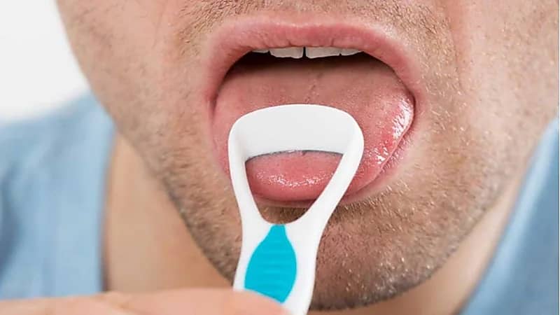 التدخين والمضادات الحيوية يصيبان شخص باللسان المشعر.. صورة