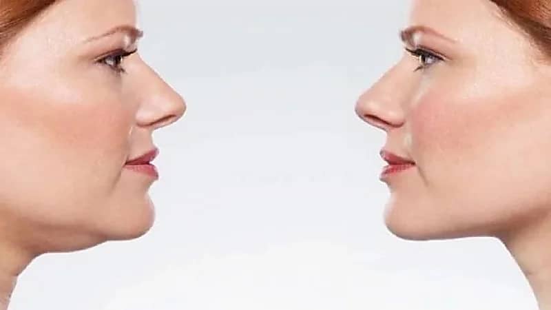 اللغلوغ مؤشر لمرض السكري.. فيديو