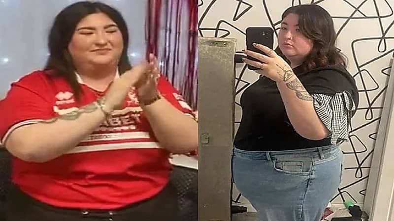 عملية تكميم تحول حياة عروس لكابوس قبل حفل زفافها.. صور