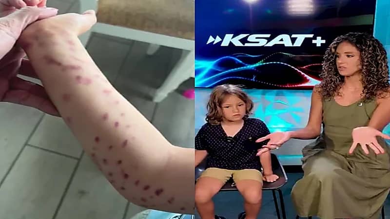 جروح خطيرة في ذراع طفل التصق أخطبوط به.. فيديو