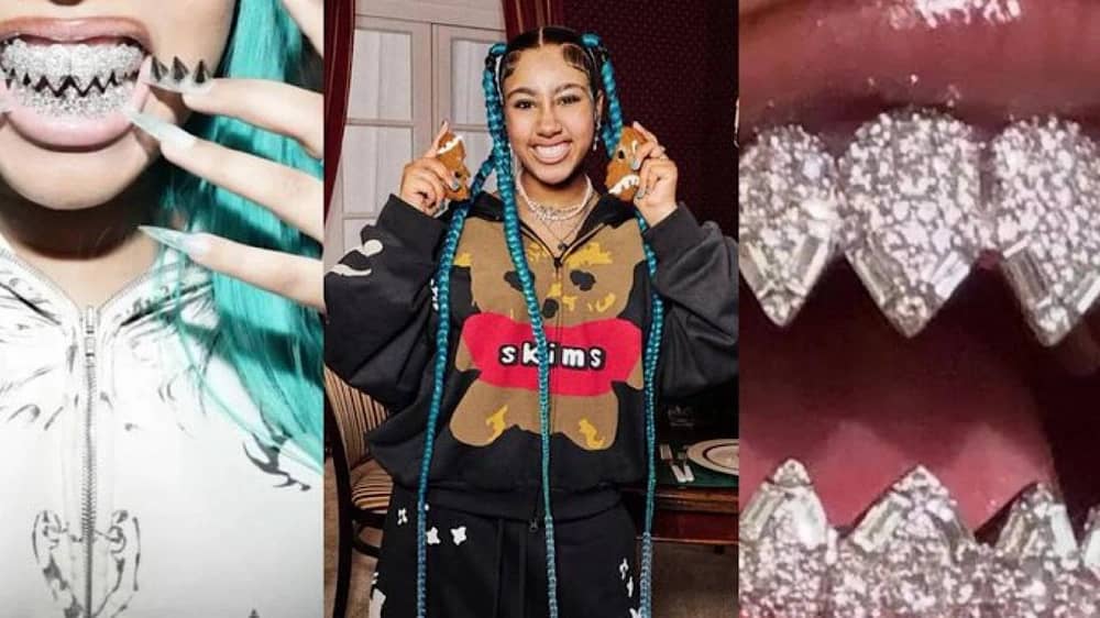 ابنة كيم كادراشيان تثير الجدل بأسنان مرصعة بالجواهر .. صور