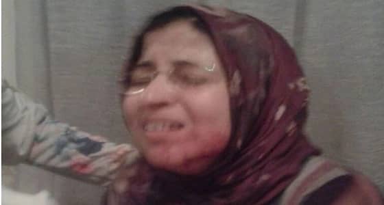 طالب يشوه وجه معلمته بالسكين