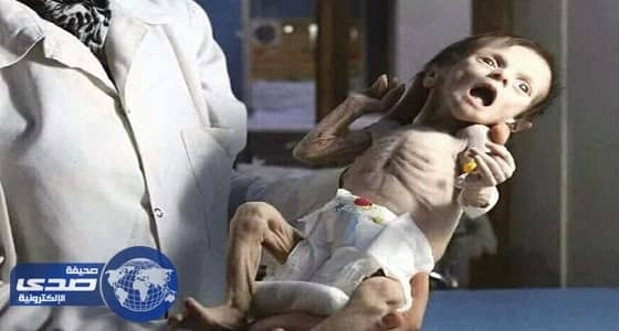 نشطاء يتهمون نظام الأسد بقتل رضيعة سورية