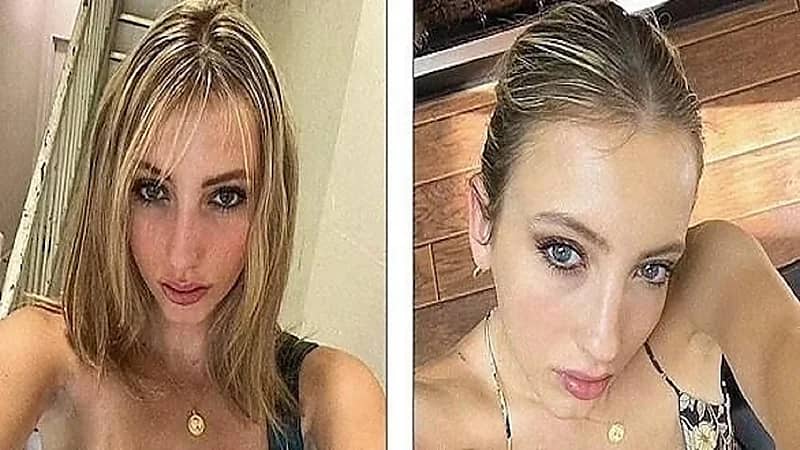 امرأة تكتشف أن قلبها على الجانب الأيمن بدلا من الأيسر