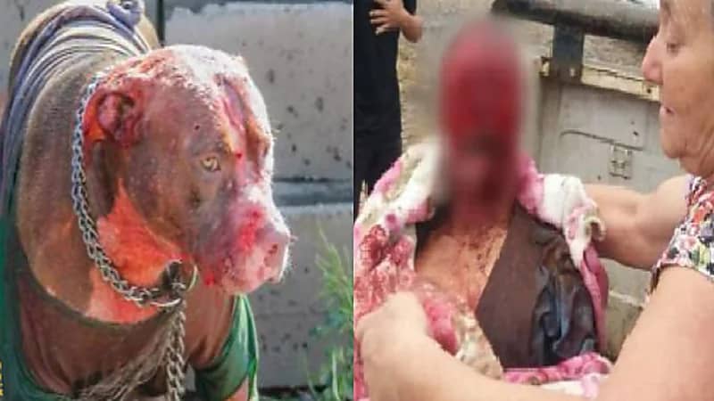 كلاب “بيتبول” تهاجم رجل وتمزق وجهه