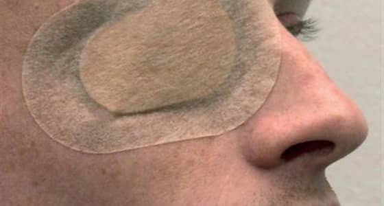 شاب يفقد بصره مدى الحياة عقب معاكسته فتاة في الشارع