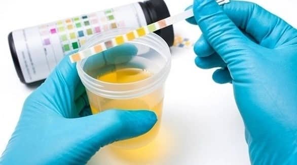 دراسة : اختبار بول بسيط يساعد على التنبؤ بمدى شيخوخة أجسادنا