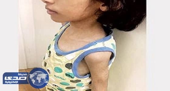 تفاصيل جديدة في واقعة الأطفال المعنفين بمكة