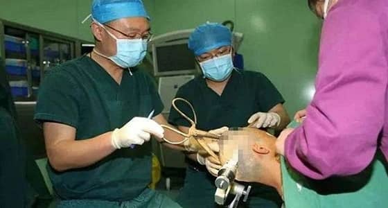 بالفيديو.. مقص يخترق جمجمة سيدة