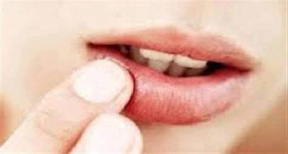 وصفة طبيعية للتخلص من تشققات الشفتين خلال الشتاء