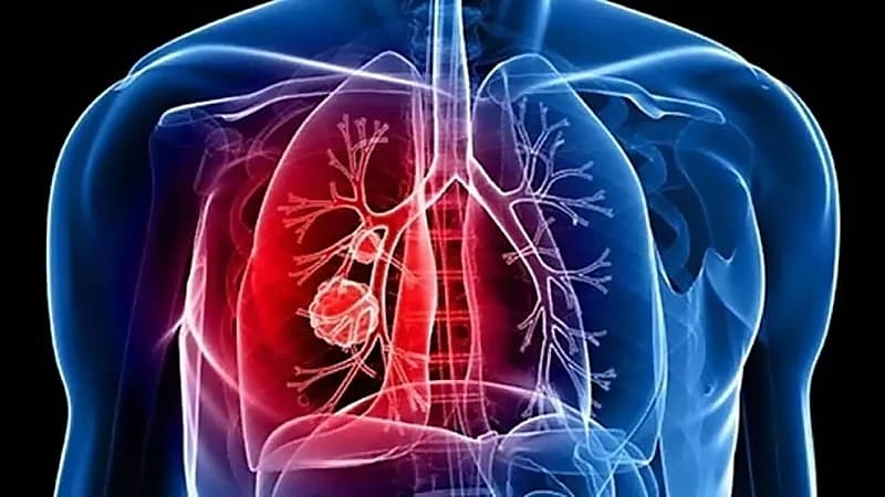 المنشطات تتسبب في إيقاف حارس ساحل العاج