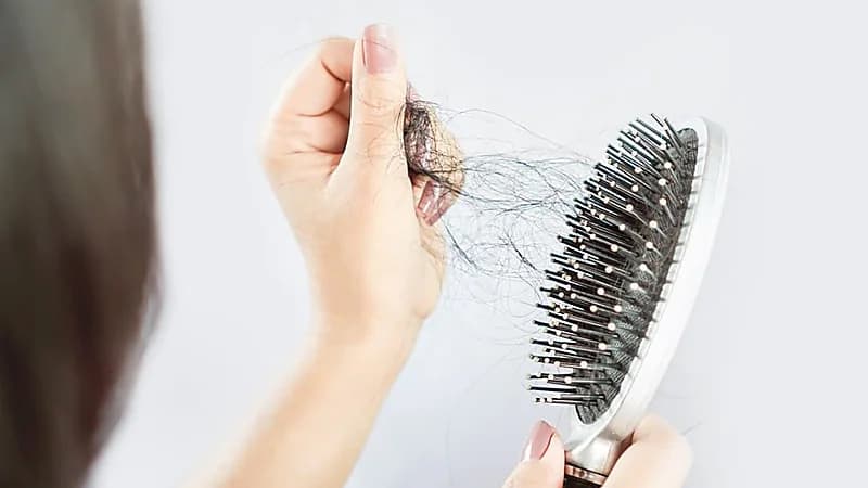 أبرز 3 أسباب لتساقط الشعر